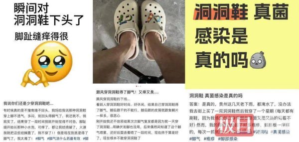 米配资 洞洞鞋竟是“真菌培养皿”？专家表示：夏日热销鞋暗藏健康风险